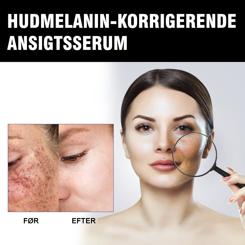 EELHOE Melanin korrigerende ansigtsserum