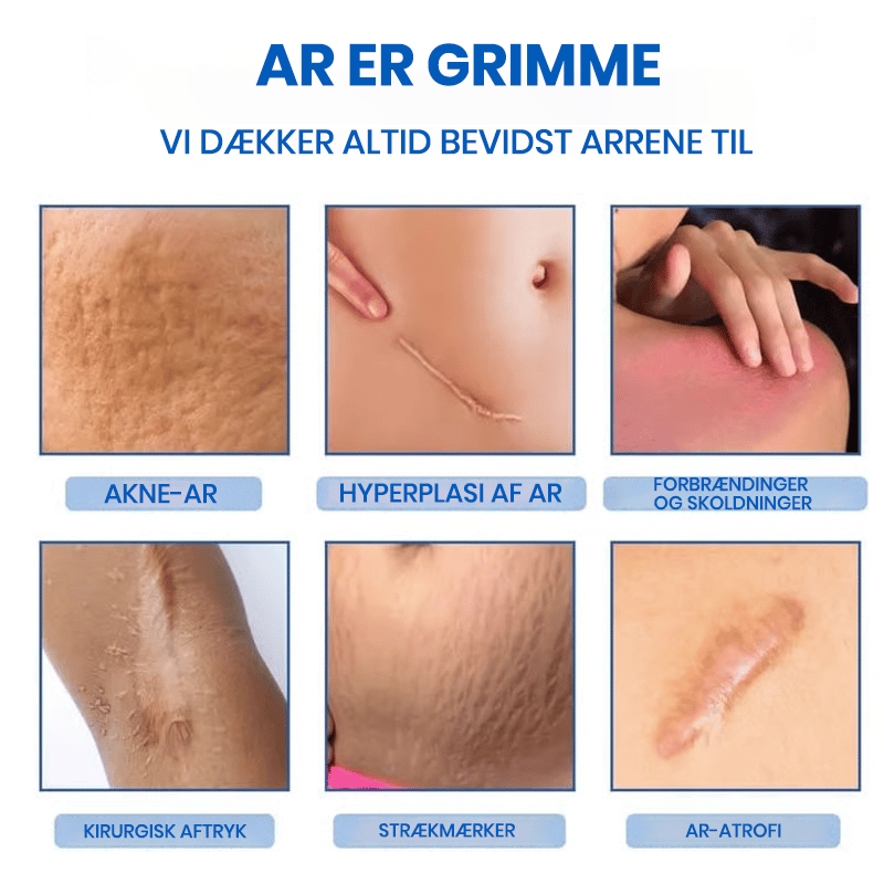 Professionel arfjernende gel