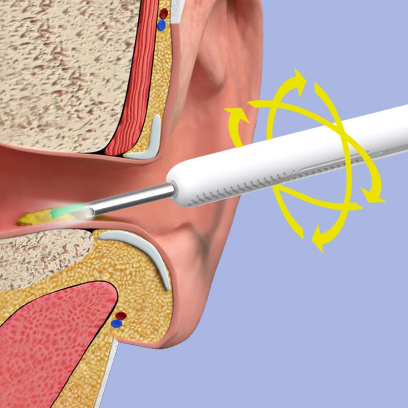 Smart visuel øreplukker