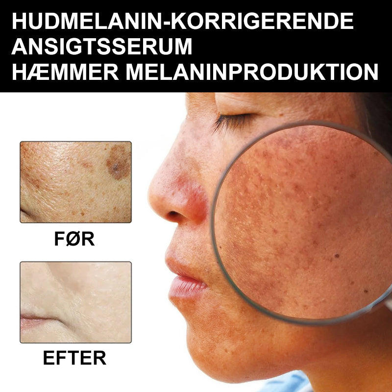 EELHOE Melanin korrigerende ansigtsserum