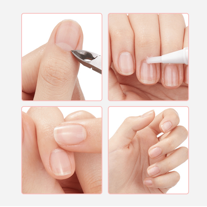 Nærende neglebåndspen