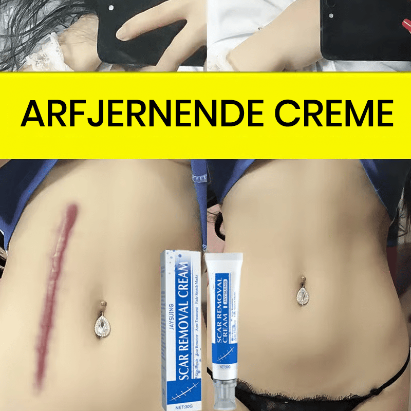 Professionel arfjernende gel